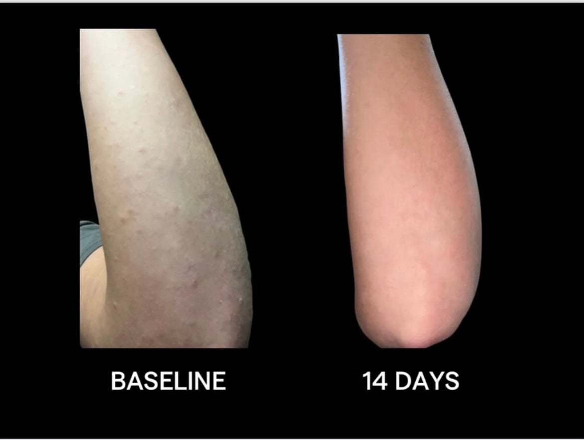 SIV Biome Balancing Serum