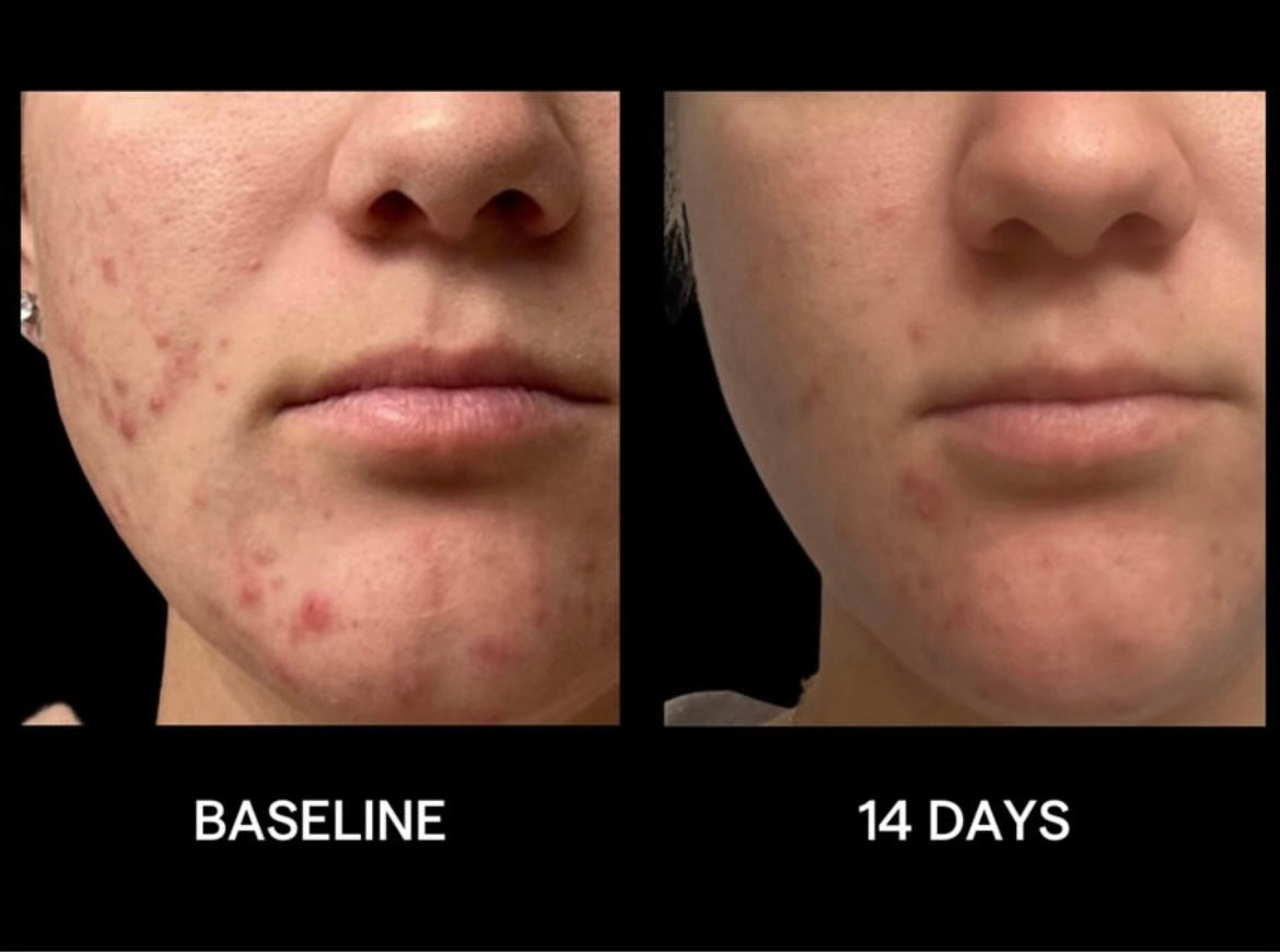Biome Balancing Serum