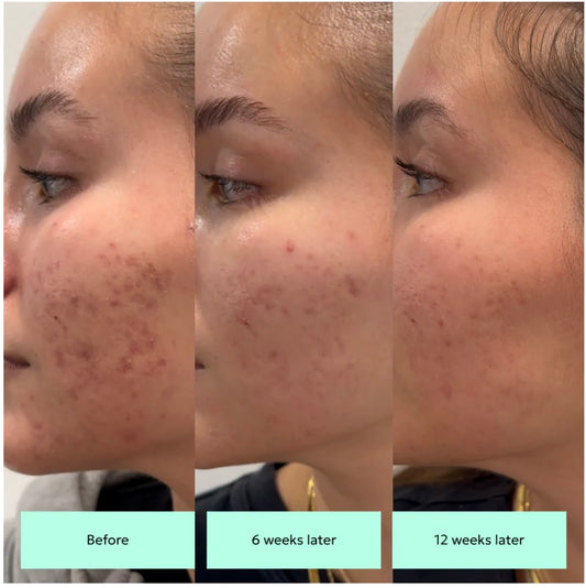 HYPERFIX Fading Toner