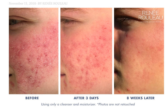 Skin Recovery Lotion