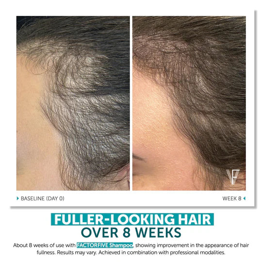 FACTORFIVE SHAMPOO ADVANCED HAIRCARE