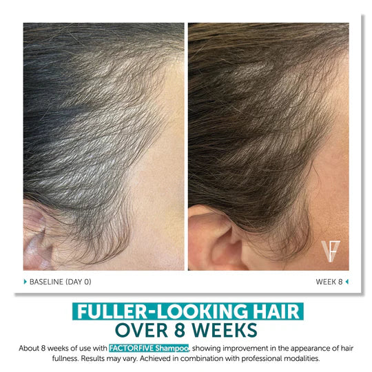 FACTORFIVE SHAMPOO ADVANCED HAIRCARE