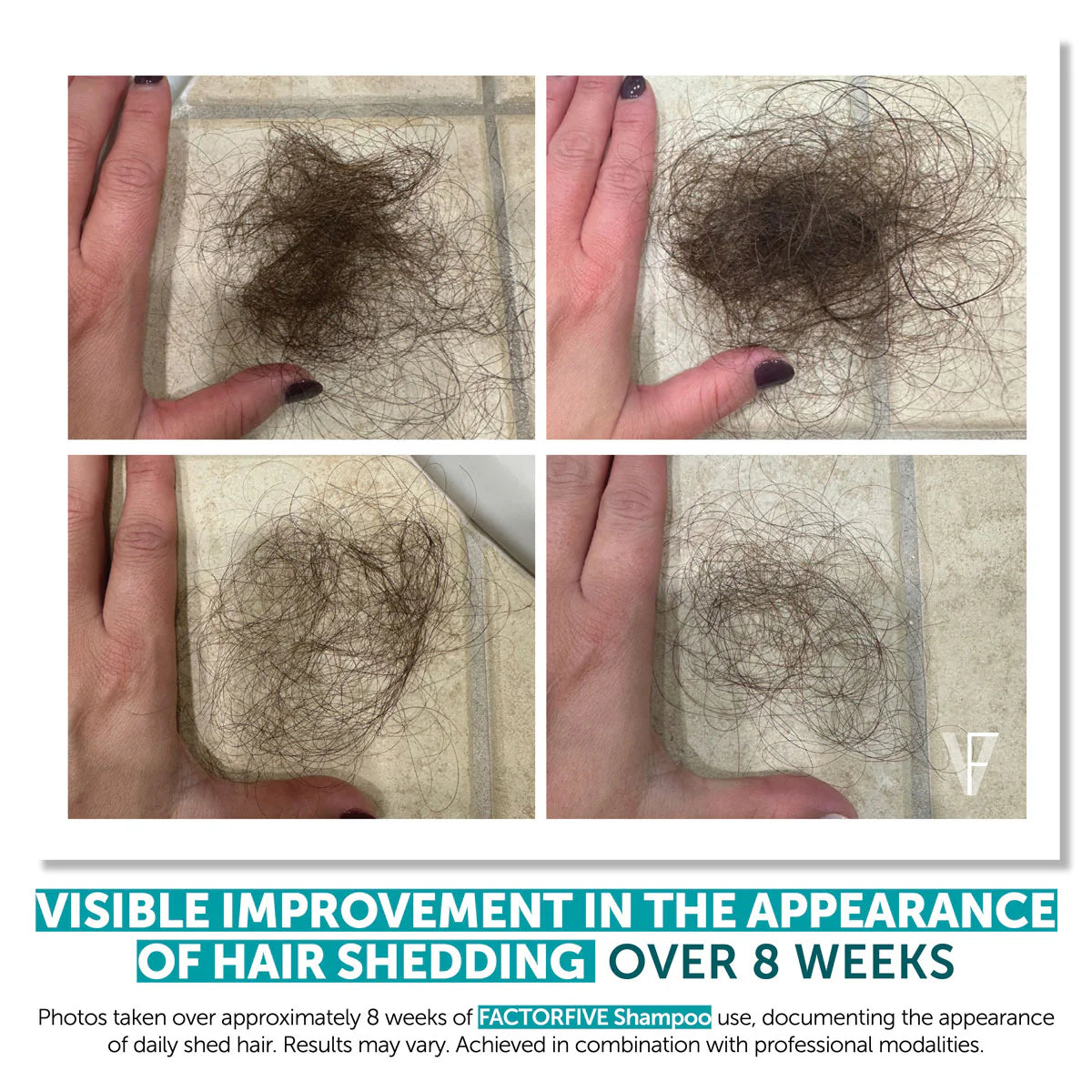 FACTORFIVE SHAMPOO ADVANCED HAIRCARE