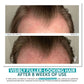 FACTORFIVE SHAMPOO ADVANCED HAIRCARE